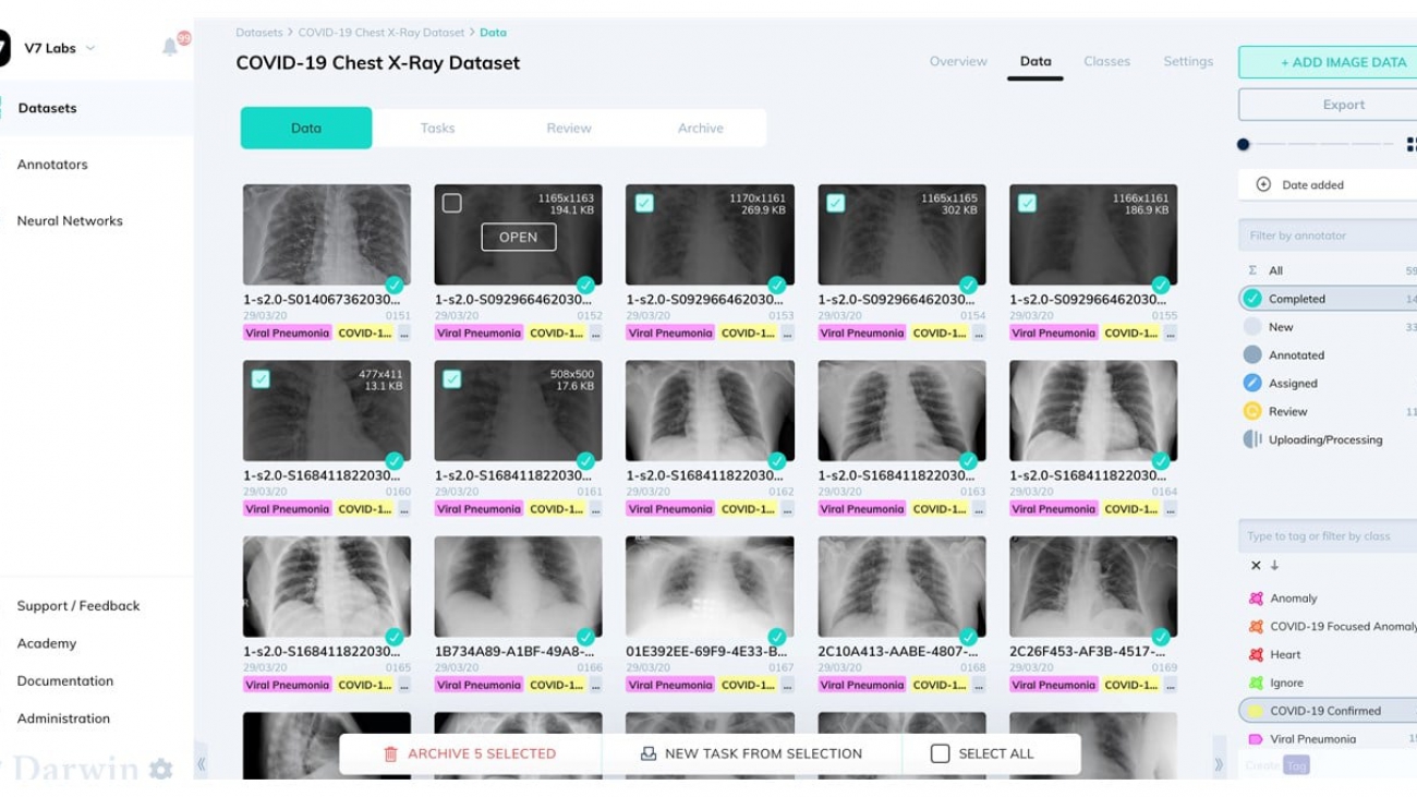 Pixel Perfect: V7 Labs Automates Image Annotation for Deep Learning Models