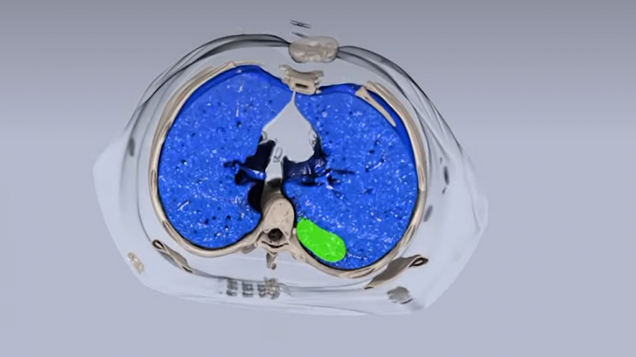 Bringing Enterprise Medical Imaging to Life: RSNA Highlights What’s Next for Radiology