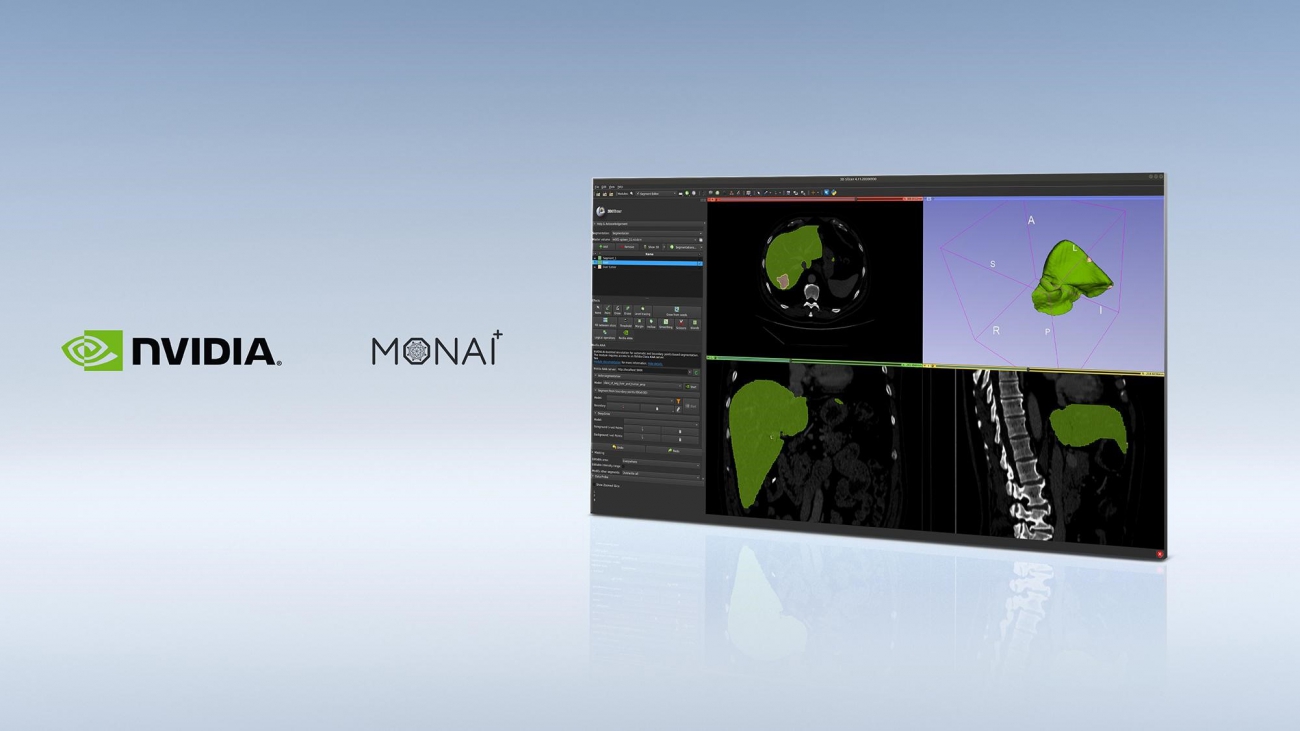 MONAI Imaging Framework Fast-Tracked to Production to Accelerate AI in Healthcare
