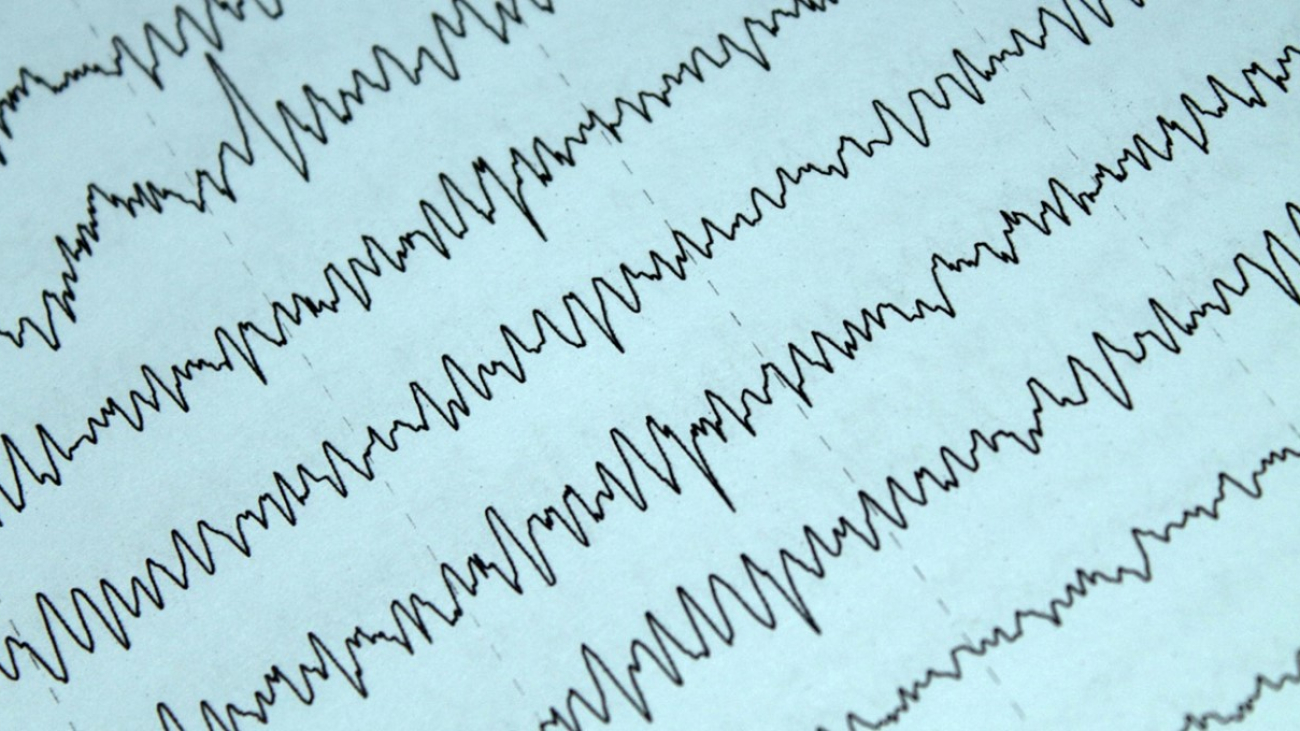 Scientists Improve Delirium Detection Using AI and Rapid-Response EEGs