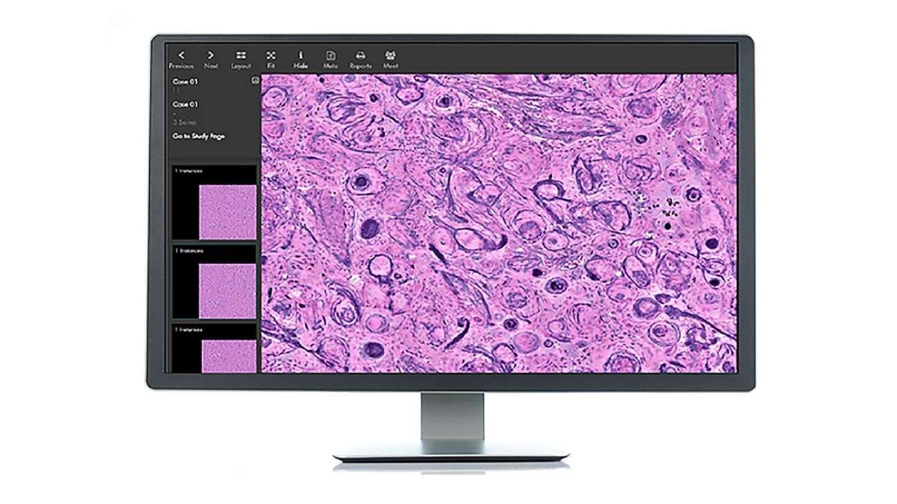 The Fastest Path: Healthcare Startup Uses AI to Analyze Cancer Cells in the Operating Room